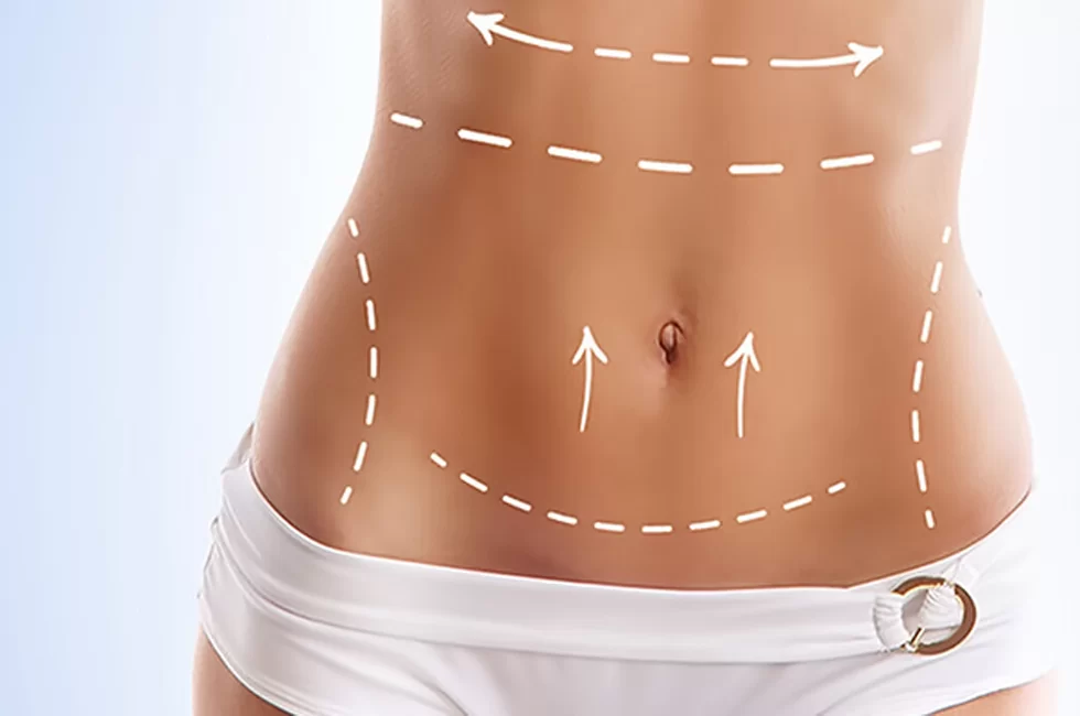 plastic surgery sedat tatar tummy tuck