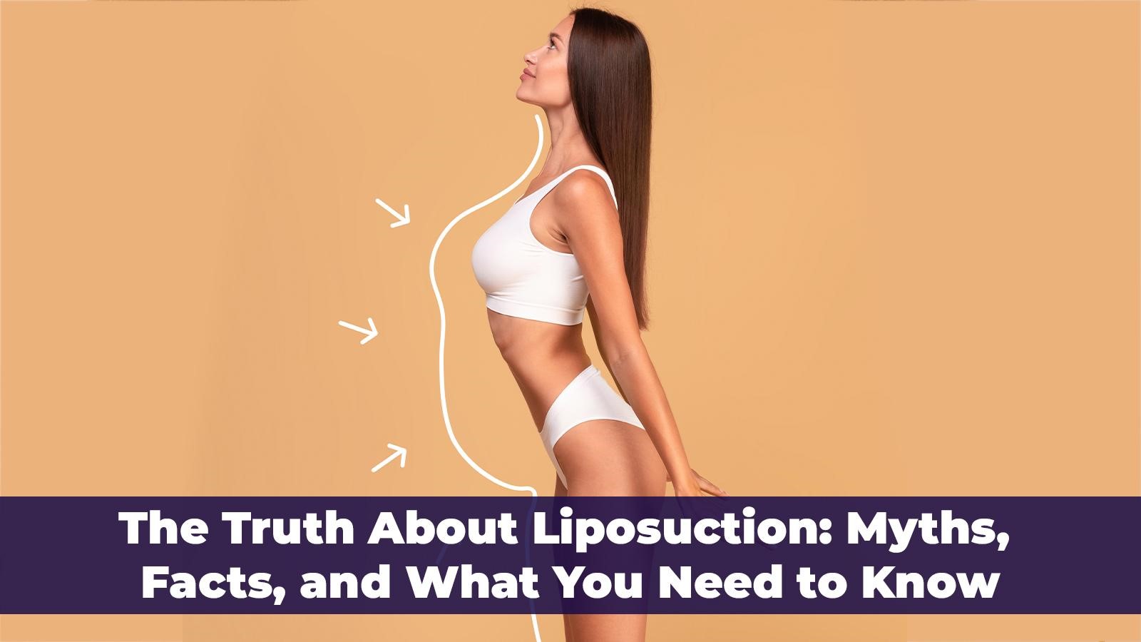 The Truth About Liposuction: Myths, Facts, and What You Need to Know