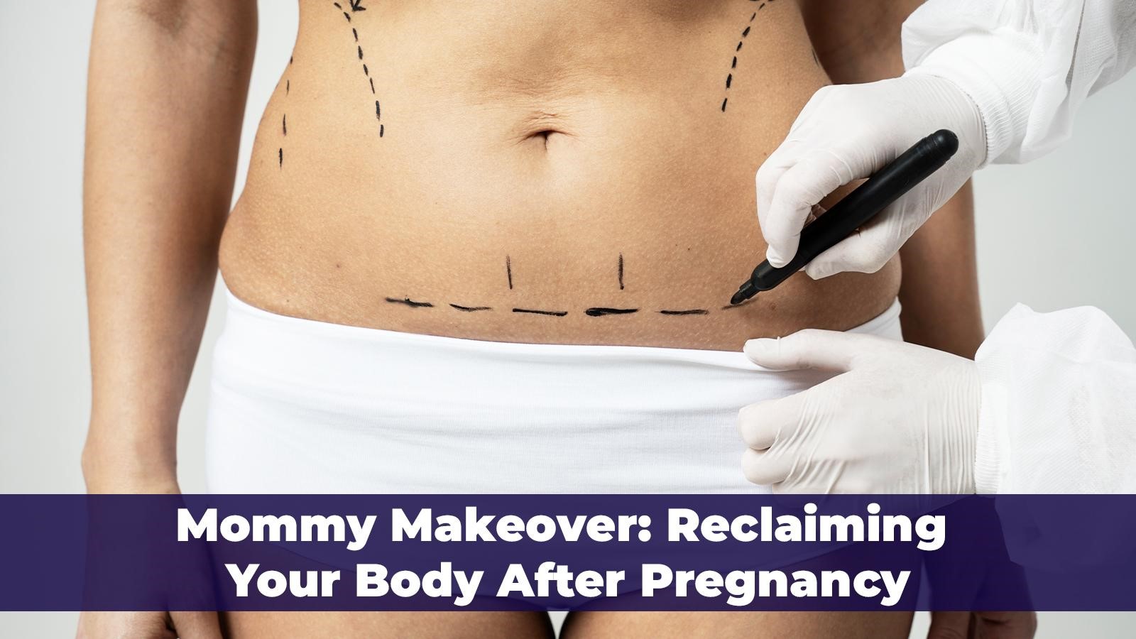 Reclaim your body after pregnancy with a mommy makeover, a transformative journey tailored to restore your confidence and vitality. Trust Sedat Tatar.