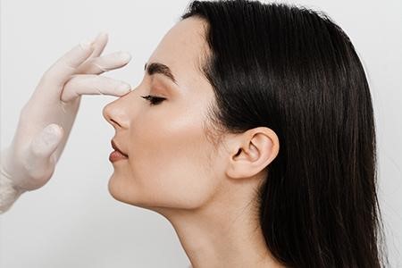 rhinoplasty before and after photos