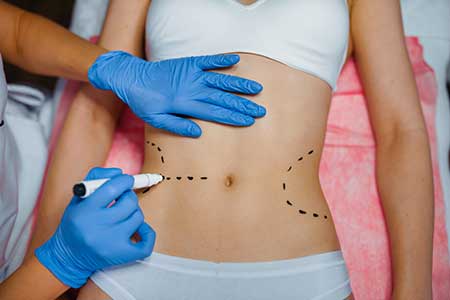 tummy tuck surgeon in turkey