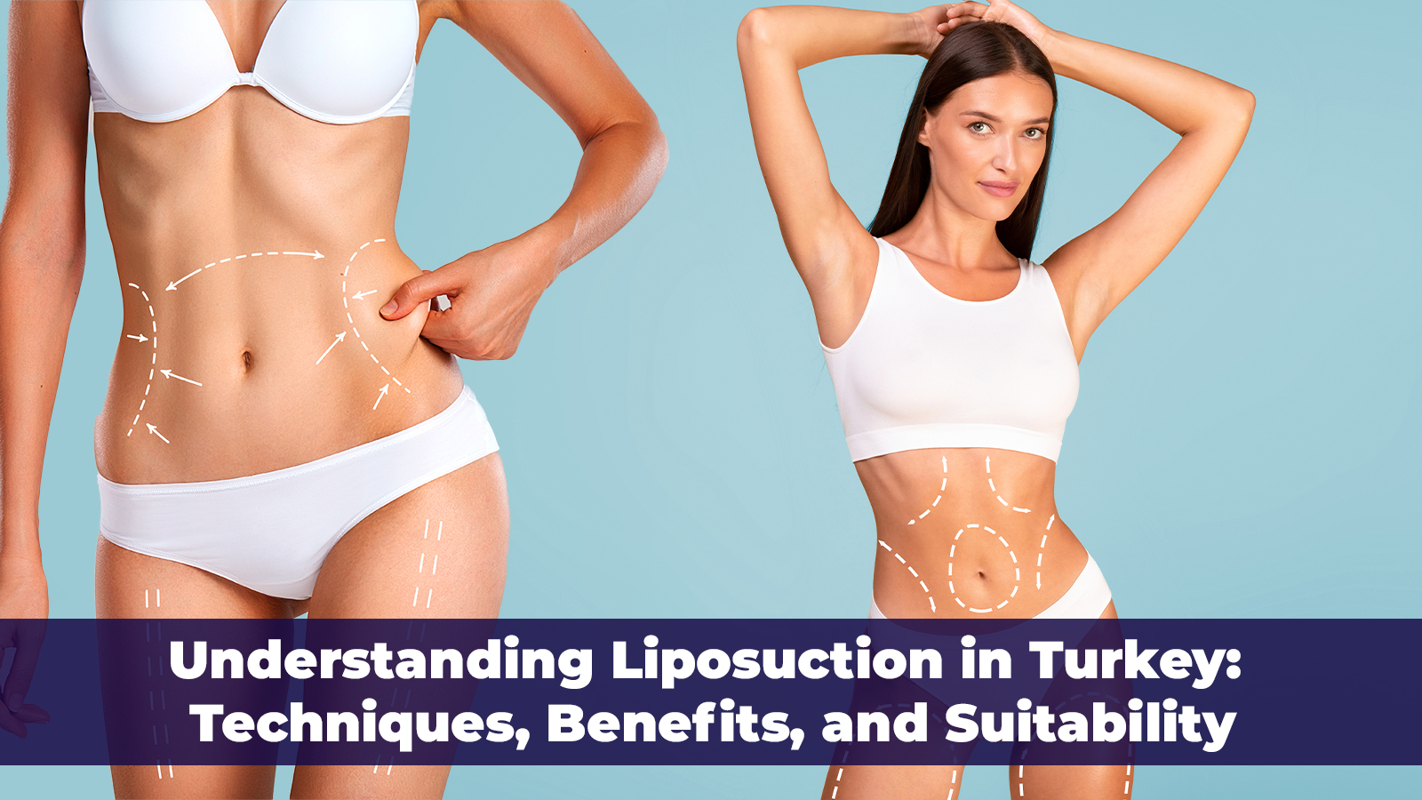 Understanding Liposuction in Turkey: Learn about the various techniques and advantages.