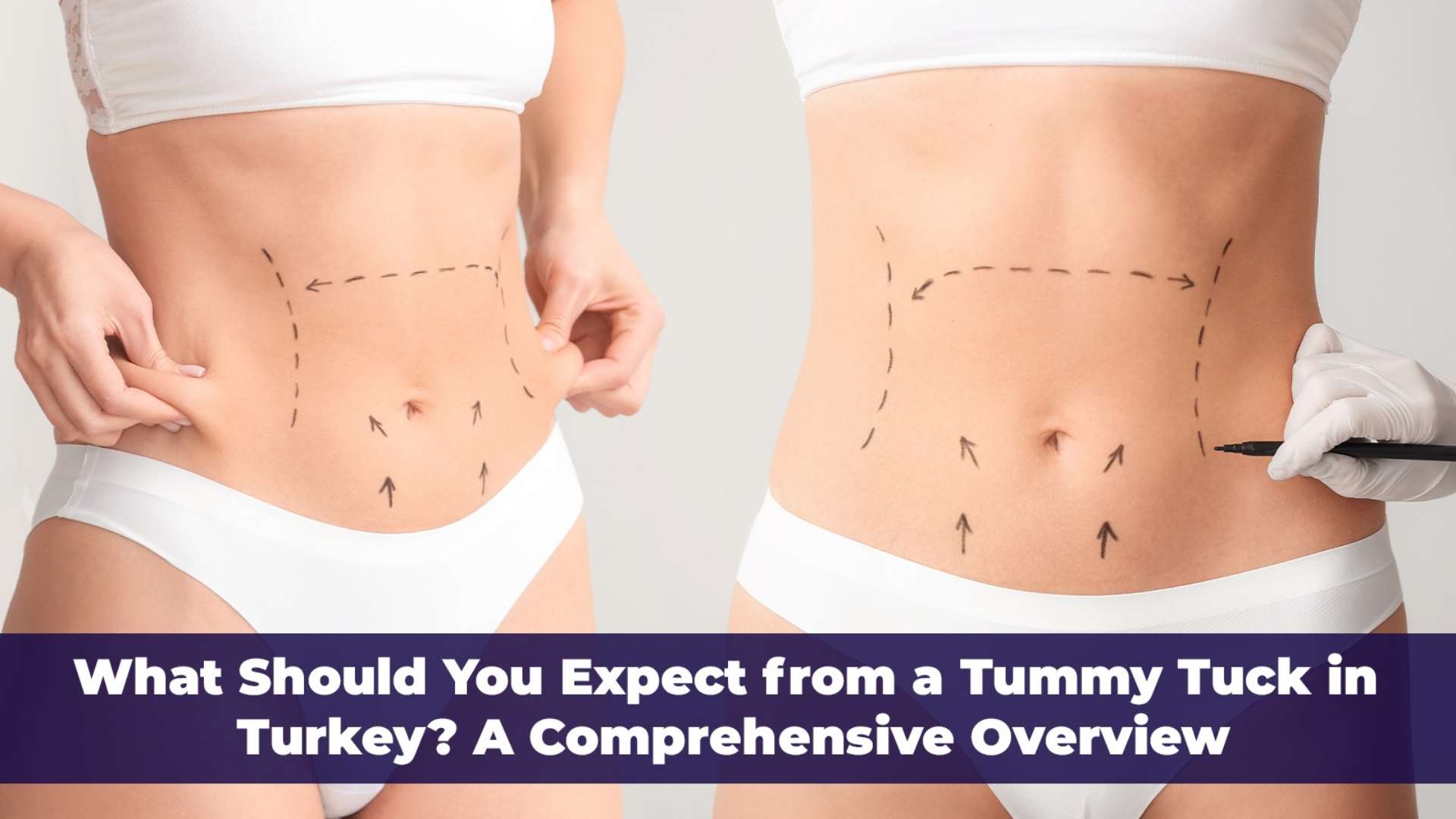 Discover what to expect from a tummy tuck in Turkey. Learn about the procedure, recovery, and benefits in this comprehensive overview.