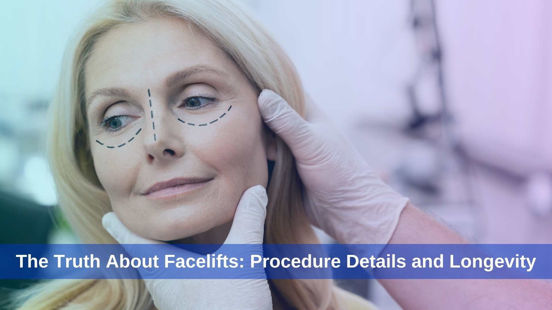 The Truth About Facelifts Procedure Details and Longevity in Turkey, exploring advanced techniques.