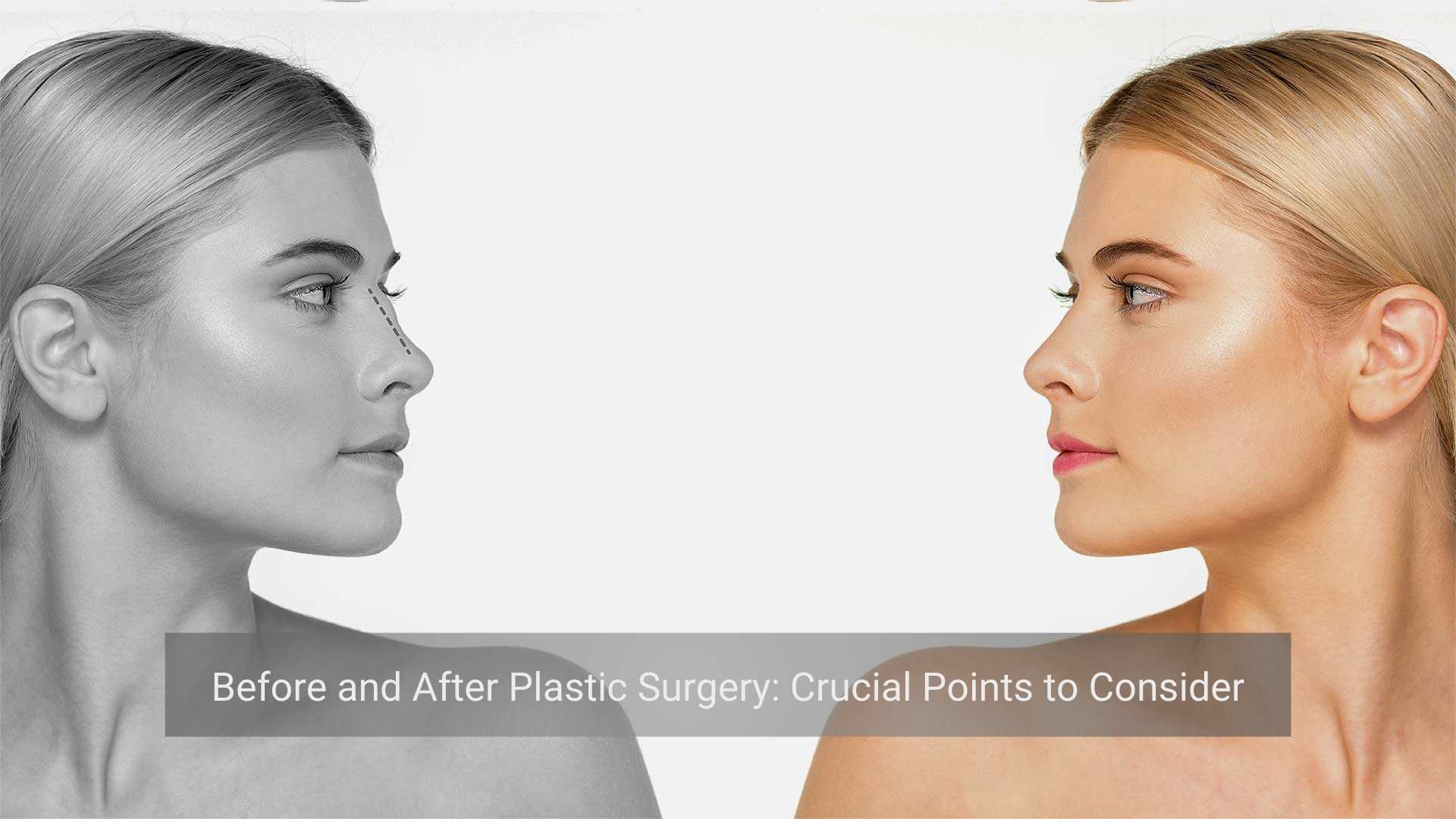 Key aspects to evaluate before undergoing and after completing plastic surgery procedures.