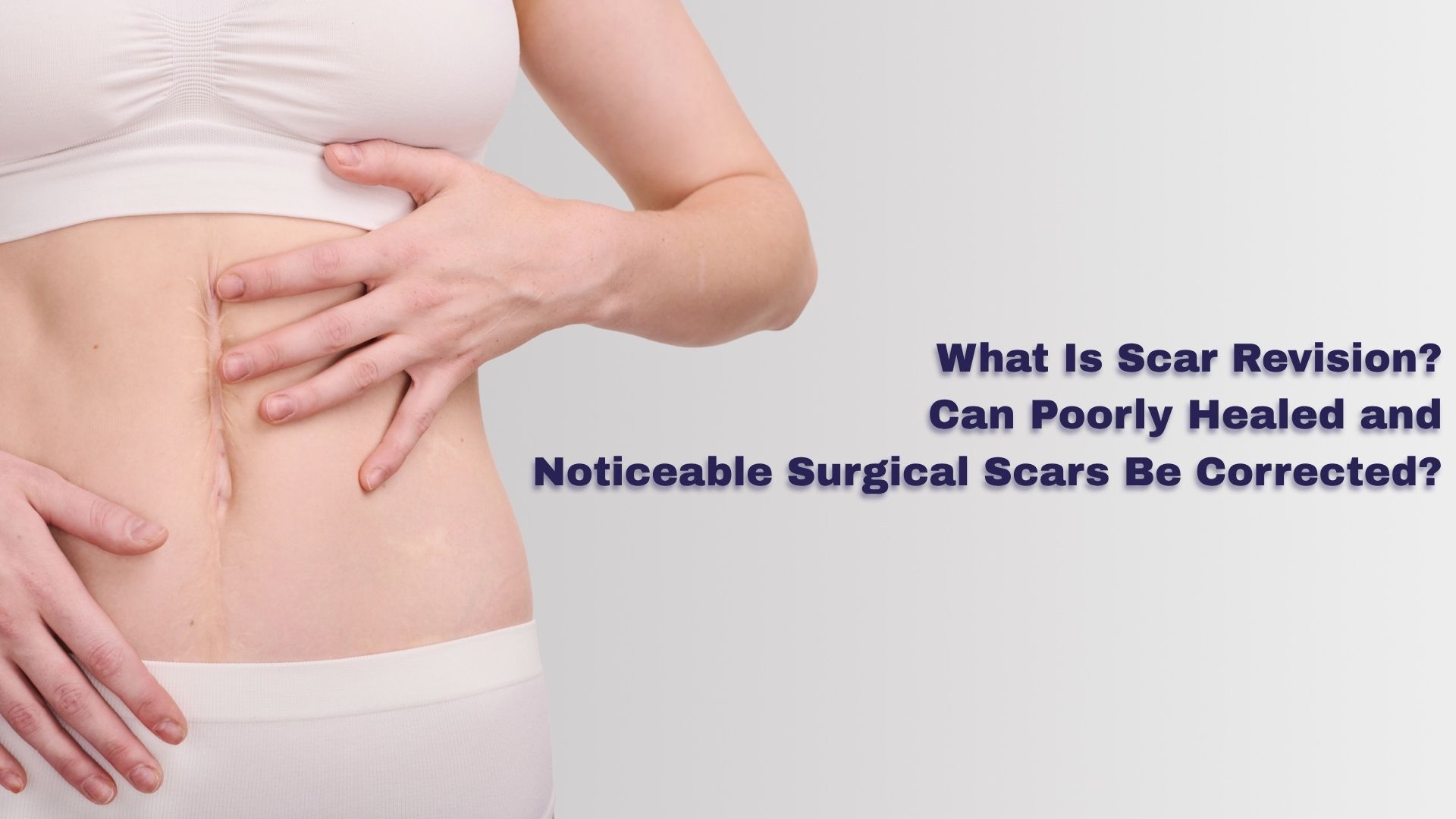 Se Scars What Is Scar Revision? Can Poorly Healed and Noticeable Surgical Scars ...